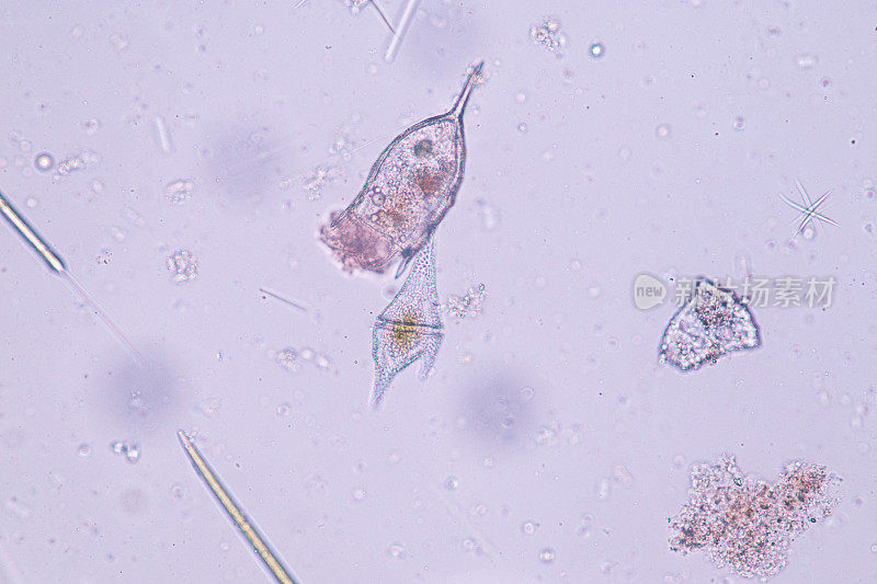铈/甲藻(原生动物)显微镜下。